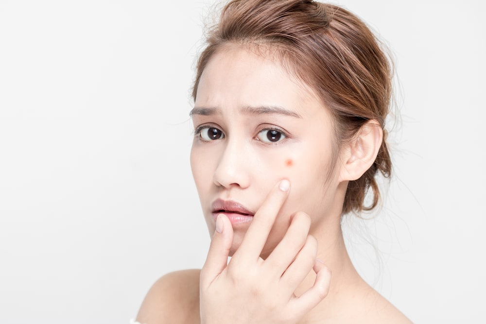 Woman points to a brown spot on her face as she looks forward to an IPL treatment to remove it