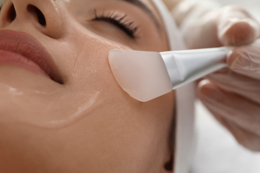 Woman's face, with eyes closed, as an aesthetic specialist applies a chemical peel