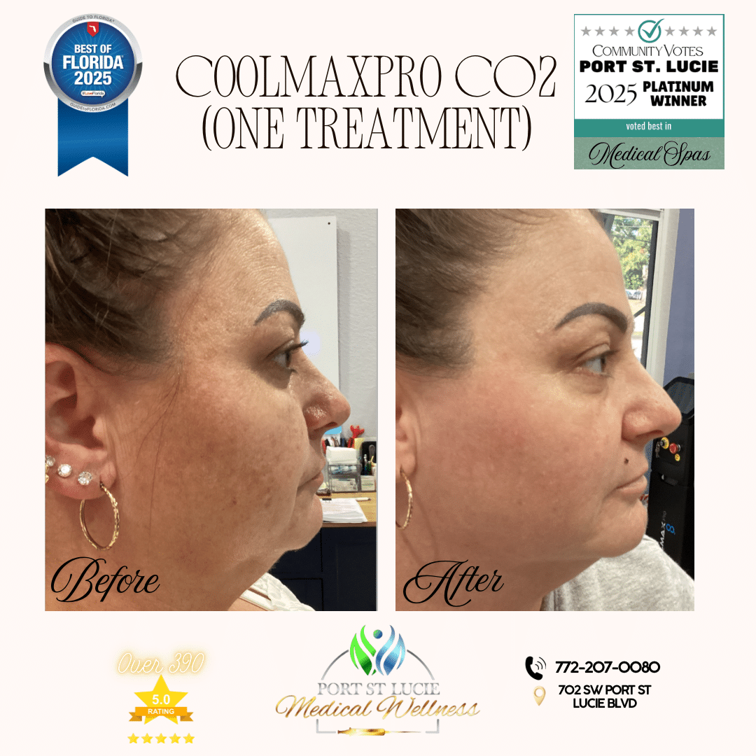 Before and After Image: COOLMAXPRO CO2 - right-side